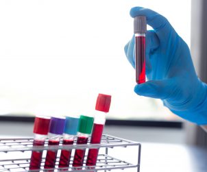 Analityk laboratoryjny trzyma w dłoni probówkę z krwią pacjenta. /Źródło: 123rf.com