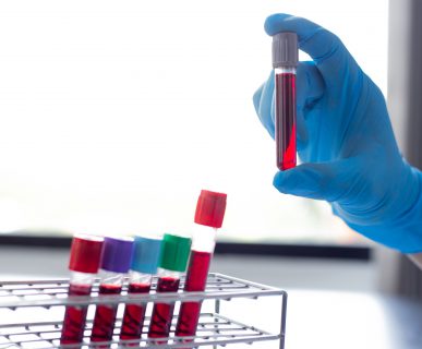 Analityk laboratoryjny trzyma w dłoni probówkę z krwią pacjenta. /Źródło: 123rf.com