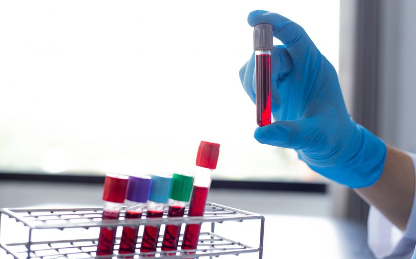 Analityk laboratoryjny trzyma w dłoni probówkę z krwią pacjenta. /Źródło: 123rf.com