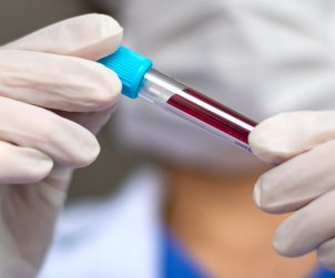 Pielęgniarz prezentujący fiolkę z krwią. /Źródło: 123rf.com