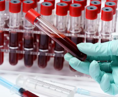 Analityk medyczny trzyma w dłoniach fiolkę z krwią pacjenta. /Źródło: 123rf.com