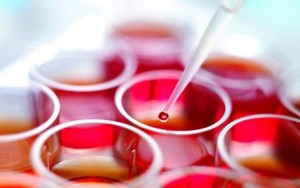 badania laboratoryjne krwi Racibórz koło Wodzisławia Śląskiego