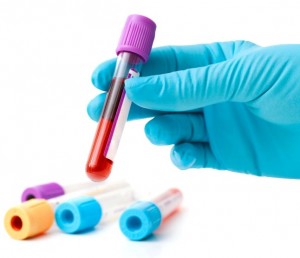 badania_laboratoryjne_bełżyce