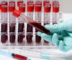 Analityk medyczny trzyma w dłoni fiolkę z krwią pobraną pacjentowi, aby poddać ją diagnostyce. /Źródło: 123rf.com