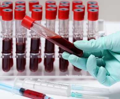 Analityk medyczny trzyma w dłoni fiolkę z krwią pobraną pacjentowi, aby poddać ją diagnostyce. /Źródło: 123rf.com