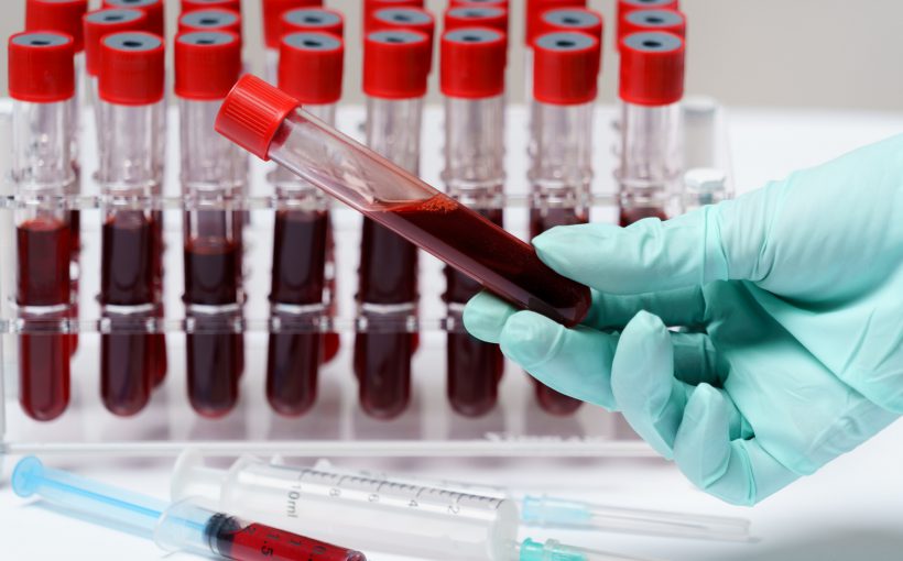Analityk medyczny trzyma w dłoni fiolkę z krwią pobraną pacjentowi, aby poddać ją diagnostyce. /Źródło: 123rf.com