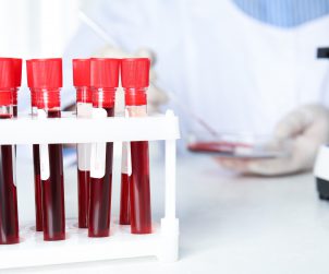 Pojemnik z ułożonymi fiolkami z pobraną krwią pacjentów. W tle technik medyczny poddaje analizie próbkę krwi. /Źródło: 123rf.com