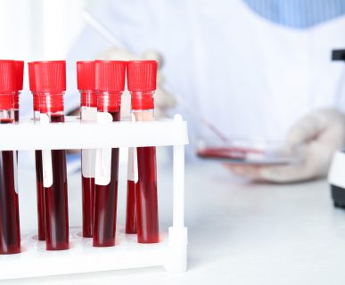 Pojemnik z ułożonymi fiolkami z pobraną krwią pacjentów. W tle technik medyczny poddaje analizie próbkę krwi. /Źródło: 123rf.com