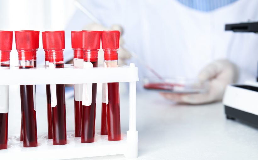 Pojemnik z ułożonymi fiolkami z pobraną krwią pacjentów. W tle technik medyczny poddaje analizie próbkę krwi. /Źródło: 123rf.com