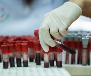 Analityk laboratoryjny wyciąga z organizera fiolkę z krwią, aby poddać ją analizie. /Źródło: 123rf.com