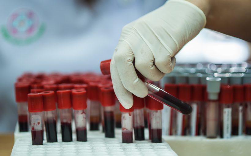 Analityk laboratoryjny wyciąga z organizera fiolkę z krwią, aby poddać ją analizie. /Źródło: 123rf.com