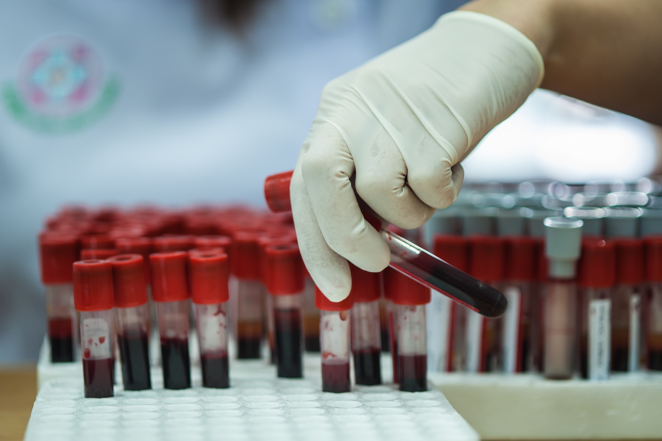 Analityk laboratoryjny wyciąga z organizera fiolkę z krwią, aby poddać ją analizie. /Źródło: 123rf.com