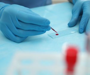 Analityk medyczny poddaje diagnostyce krew pacjenta. /Źródło: 123rf.com