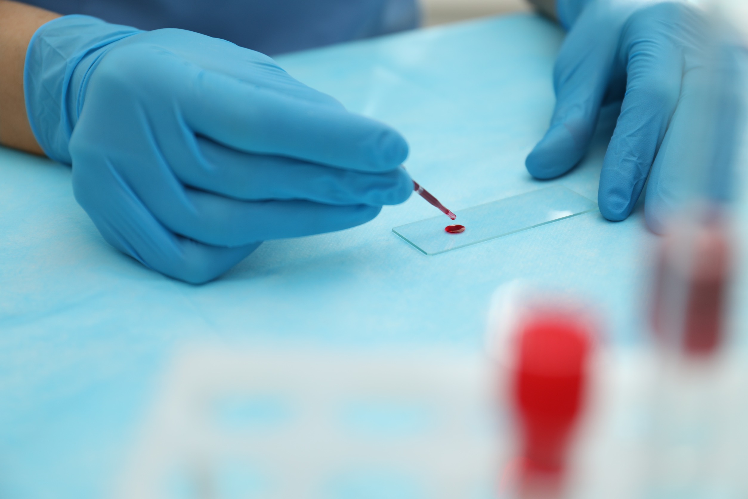 Analityk medyczny poddaje diagnostyce krew pacjenta. /Źródło: 123rf.com