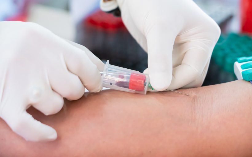 Pielęgniarka pobiera krew pacjentowi z żyły u ręki w celu diagnostyki laboratoryjnej. /Źrodło: 123rf.com
