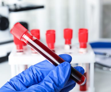 Analityk laboratoryjny ma w dłoni fiolkę wypełnioną krwią pacjenta. /Źródło: 123rf.com