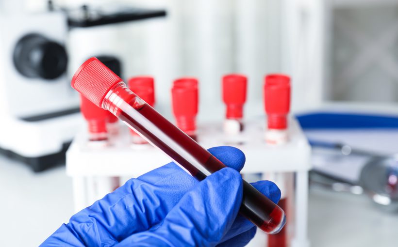 Analityk laboratoryjny ma w dłoni fiolkę wypełnioną krwią pacjenta. /Źródło: 123rf.com