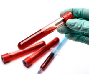 Analityk laboratoryjny trzyma w dłoni fiolkę wypełnioną krwią. /Źródło: 123rf.com