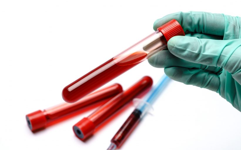 Analityk laboratoryjny trzyma w dłoni fiolkę wypełnioną krwią. /Źródło: 123rf.com