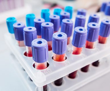 Organizer z ułożonymi numerycznie fiolkami z krwią pobraną w celu analizy laboratoryjnej. /Źródło: 123rf.com