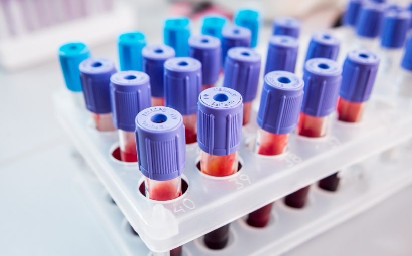Organizer z ułożonymi numerycznie fiolkami z krwią pobraną w celu analizy laboratoryjnej. /Źródło: 123rf.com