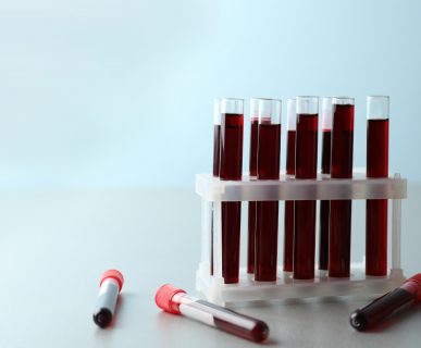 Fiolki wypełnione krwią ułożone w plastikowym organizerze. /Źródło: 123rf.com