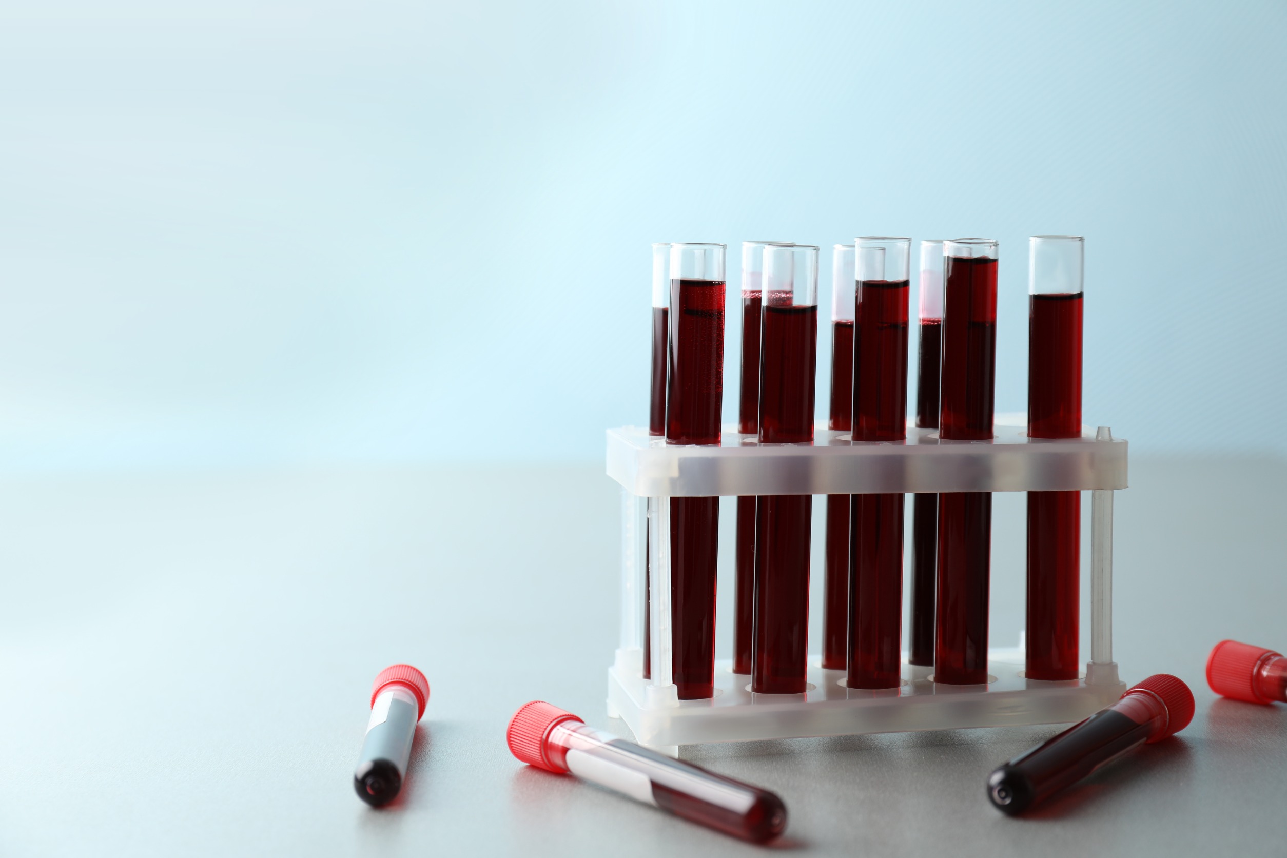 Fiolki wypełnione krwią ułożone w plastikowym organizerze. /Źródło: 123rf.com