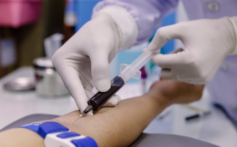 Pielęgniarka pobiera pacjentowi krez z żyły u ręki. /Źródło: 123rf.com