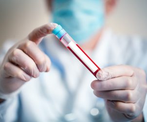Analityk medyczny trzyma w dłoni probówkę wypełnioną krwią pacjenta. /Źródło: 123rf.com