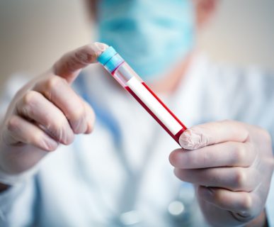 Analityk medyczny trzyma w dłoni probówkę wypełnioną krwią pacjenta. /Źródło: 123rf.com