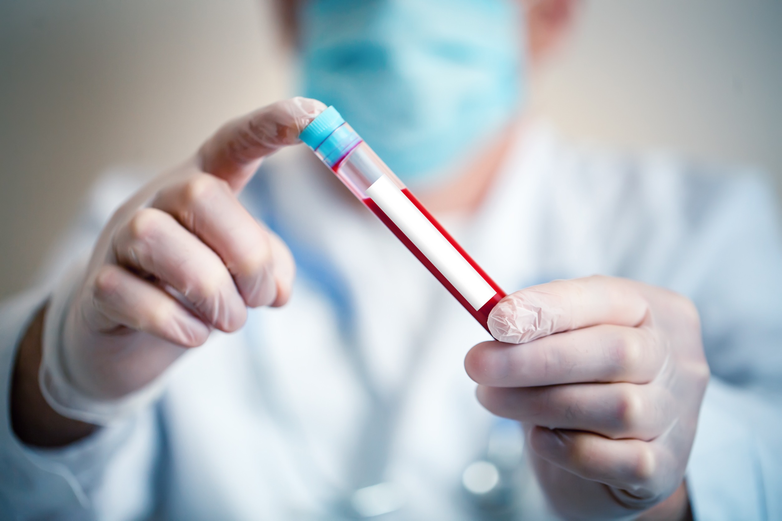 Analityk medyczny trzyma w dłoni probówkę wypełnioną krwią pacjenta. /Źródło: 123rf.com