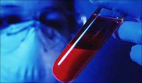 badania laboratoryjne krwi lidzbark welski