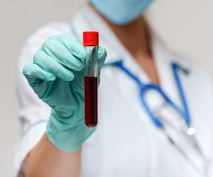 Młoda pielęgniarka trzyma w dłoni probówkę wypełnioną krwią. /Źródło: 123rf.com
