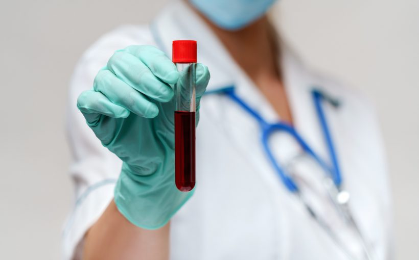 Młoda pielęgniarka trzyma w dłoni probówkę wypełnioną krwią. /Źródło: 123rf.com