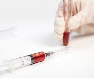 Analityk laboratoryjny poddaje analizie krew pacjenta. /Źródło: 123rf.com