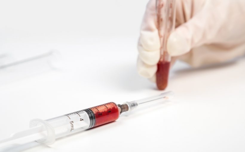 Analityk laboratoryjny poddaje analizie krew pacjenta. /Źródło: 123rf.com