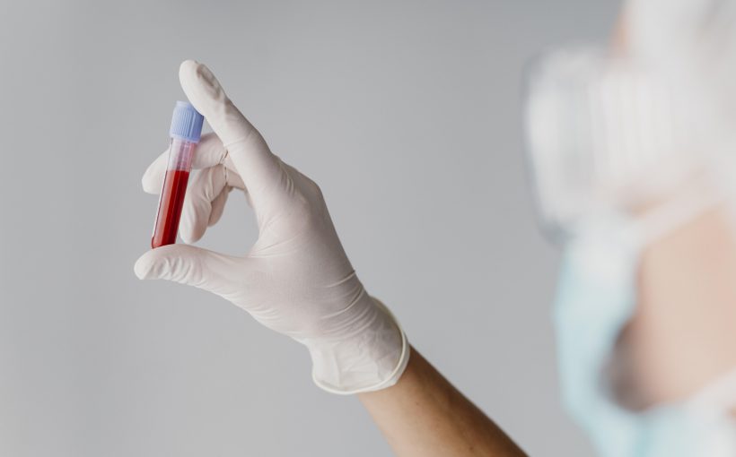 Diagnosta laboratoryjny trzyma w dłoni odzianej w białą, jednorazową rękawiczkę, fiolkę wypełnioną krwią pacjenta, pobraną w celu diagnostyki medycznej. /Źródło: 123rf.com