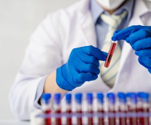 Analityk laboratoryjny ubrany w sterylny strój medyczny trzyma w dłoni probówkę wypełnioną próbką krwi pacjenta. /Źródło: 123rf.com