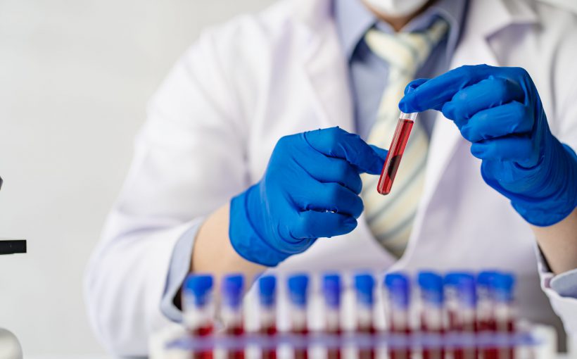 Analityk laboratoryjny ubrany w sterylny strój medyczny trzyma w dłoni probówkę wypełnioną próbką krwi pacjenta. /Źródło: 123rf.com
