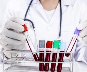 Pielęgniarka odkłada probówki z krwią pacjenta. /Źródło:123rf.com