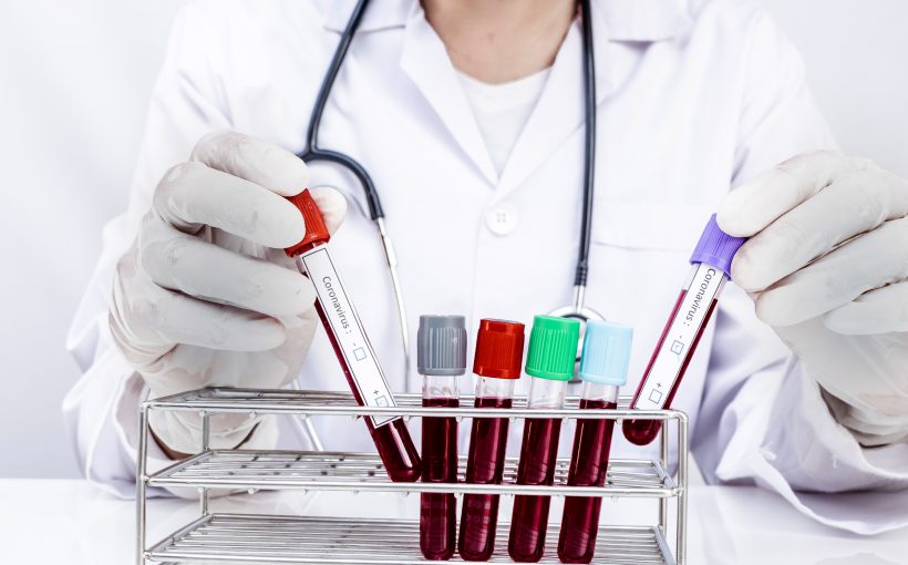 Pielęgniarka odkłada probówki z krwią pacjenta. /Źródło:123rf.com