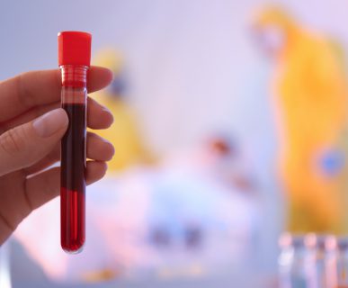Analityk laboratoryjny trzyma w dłoni fiolkę wypełnioną prawie do pełna krwią pacjenta. /Źródło: 123rf.com