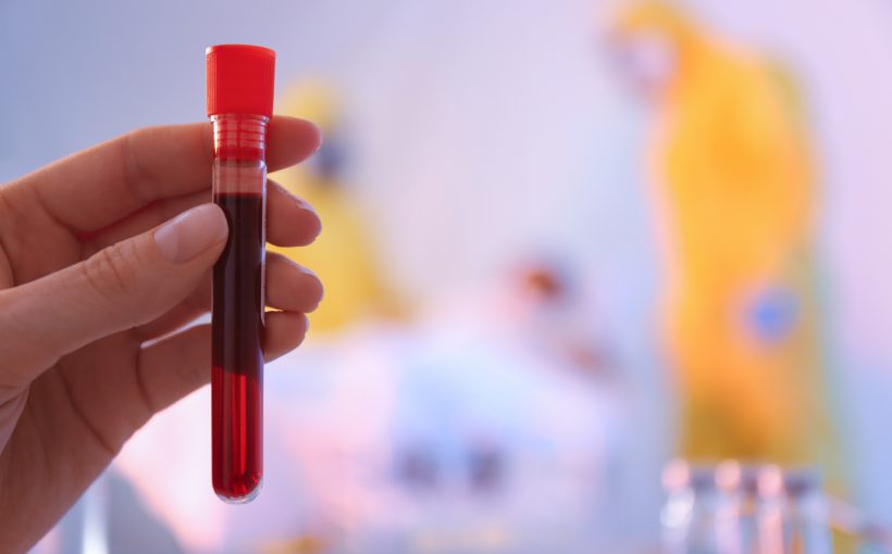 Analityk laboratoryjny trzyma w dłoni fiolkę wypełnioną prawie do pełna krwią pacjenta. /Źródło: 123rf.com
