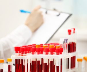 Analityk laboratoryjny opisuje znajdujące się przed nim fiolki wypełnione pobraną krwią pacjentów. /Źródło: 123rf.com