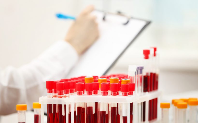 Analityk laboratoryjny opisuje znajdujące się przed nim fiolki wypełnione pobraną krwią pacjentów. /Źródło: 123rf.com