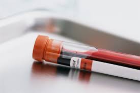 badania laboratoryjne krwi radom