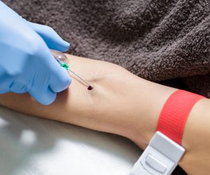 Pielęgniarka po pobraniu pacjentce krwi, usuwa z żyły igłę. /Źródło: 123rf.com