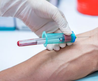 Zgięcie łokcia po wewnętrznej stronie z wbitą igłą, w celu pobrania krwi. /Źródło: 123rf.com