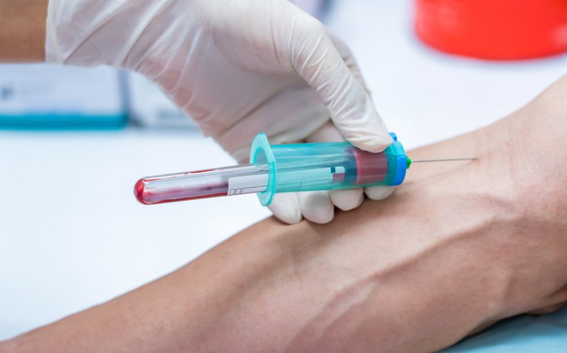 Zgięcie łokcia po wewnętrznej stronie z wbitą igłą, w celu pobrania krwi. /Źródło: 123rf.com