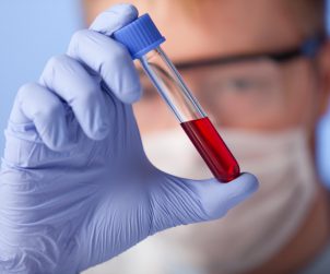 Analityk laboratoryjny w sterylnym ubraniu trzyma w dłoni fiolkę z krwią pacjenta. /Źródło: 123rf.com